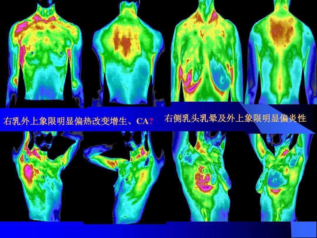 什么是热成像(军用红外热成像仪)